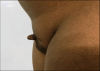 Side-profile-revealing-the-micropenis.png